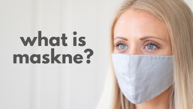 How to treat “maskne”?